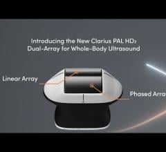 New Clarius PAL HD3 is designed for hospital physicians and nurses who need to quickly see inside the body to accurately diagnose and treat patients at the bedside.