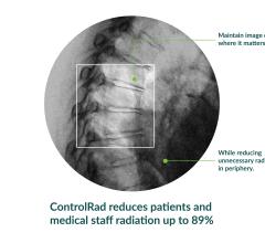 ControlRad Announces FDA Clearance and Launch of ControlRad Trace