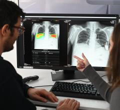 The acquisition further strengthens deepc’s leading-edge solution for radiology