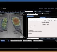 Medical imaging AI company DeepTek.ai will showcase its groundbreaking US FDA-cleared chest X-ray reporting AI solution, Augmento X-Ray, during HIMSS 2024 being held March 11-15 in Orlando, FL.