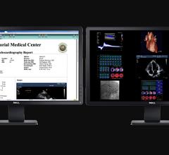 Intelerad Acquires Digisonics CVIS and OB?GYN reporting systems to Expand its Enterprise Imaging Workflow 