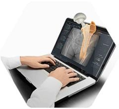 First Cases Conducted Utilizing hipEOS 3.0 and Intellijoint HIP Smart Navigation System