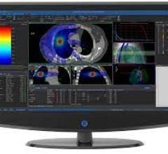 Enhancing Elekta’s radiation therapy offerings with GE HealthCare’s MIM Software medical imaging management solutions will help drive greater benefits for global healthcare systems 