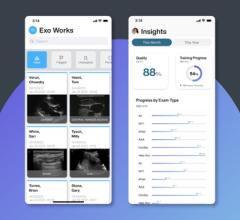 Exo Works is an intelligent and intuitive point-of-care ultrasound workflow solution that enables physicians to easily document, review, bill and manage quality assurance all from one platform – in seconds. (Graphic: Business Wire)