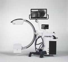 The new, advanced C-arm provides exceptional image quality and versatility for operating room procedures