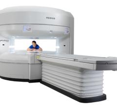 FUJIFILM Healthcare Americas Corporation, a provider of diagnostic imaging and medical informatics solutions, unveiled the Velocity MRI System, its advanced, high-field open MRI system during the 2021 Radiological Society of North America (RSNA) conference in Chicago.