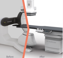 GE HealthCare Introduces Image Guiding Solutions Upgrades