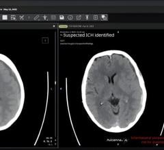 GE HealthCare's Genesis portfolio Now Available in AWS Marketplace