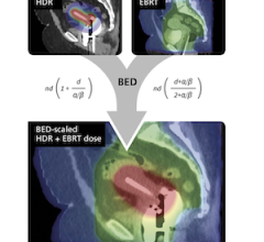 molecular imaging, gynecologic cancer
