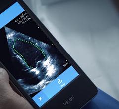 GE Healthcare Vscan with artificial intelligence (AI) automated left ventricular ejection fraction assessment with the Dia LVivo EF app. #ASE2020 #AI