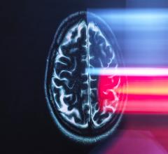 Using a specialized MRI sensor, MIT researchers have shown that they can detect light deep within tissues such as the brain.