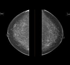 The American College of Radiology (ACR), Society of Breast Imaging (SBI), patient advocates and others secured an extension of the moratorium on harmful 2009 and 2016 United States Preventive Services Task Force (USPSTF) Breast Cancer Screening Guidelines from Dec. 31, 2021 to Dec. 31, 2022.