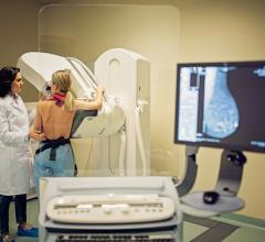 The global breast imaging technologies market was valued at USD 3.54 billion in 2019 and is projected to surpass USD 7.43 billion by 2030, expanding at a CAGR of 6.90% during the forecast period from 2020 to 2030.