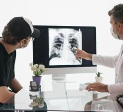 The American College of Radiology (ACR) lung cancer screening FAQ resource has been updated to reflect the latest changes in coverage criteria released Feb.10 by the Centers for Medicare and Medicaid Services (CMS) in a final coverage decision memorandum. 