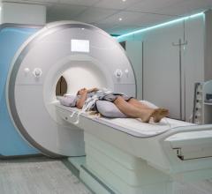 Widespread misconceptions regarding the safety of MRIs are a barrier to Canadians receiving essential cancer and disease screenings 