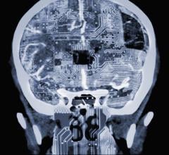 RSNA and four other radiology societies from around the world, including the American College of Radiology (ACR), have issued a joint statement on the development and use of artificial intelligence (AI) tools in radiology 