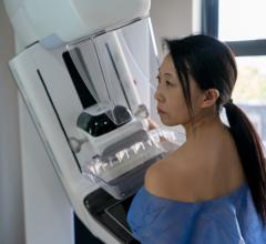 Attending the two most recent screening appointments before a breast cancer diagnosis protects against breast cancer death, according to a Queen Mary University of London study of over half a million Swedish women conducted over 24 years
