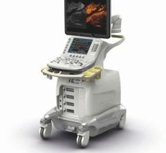 Hoya Corp. and Hitachi, Ltd. announced a five year contract regarding Endoscopic Ultrasound Systems [EUS] by which the parties will strengthen technical collaboration, and Hitachi will continue supplying diagnostic ultrasound systems and ultrasound sensor related parts used in EUS.