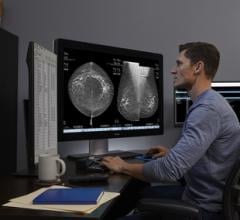 Study: AI-Powered Mammography Technology Helps Flag Breast Cancer Cases Initially Interpreted as Negative 