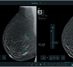 Studies show new deep-learning algorithm helps radiologists detect breast cancers in their early stages when used with the Genius 3D Mammography exam