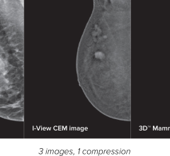 Partnership includes education and training to increase clinician confidence in the use of CEM, an emerging breast imaging modality 