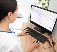 Hyland, Tribun Health Team Up to Deliver Next-Generation, Intelligent Digital Pathology