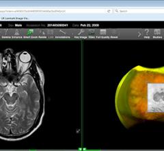 Hyland Healthcare Adds ImageNext Imaging Workflow Optimizer to Enterprise Imaging Suite