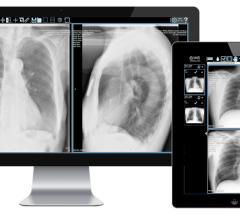IMS to Unveil Prototype Imaging Machine Learning Platform at HIMSS19