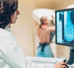 The American College of Radiology (ACR) and Society of Breast Imaging (SBI) has submitted joint comments in response to the United States Preventive Services Task Force (USPSTF) draft recommendations for breast cancer screening.