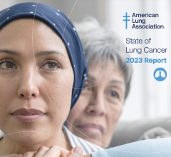 The American Lung Association’s newly-released ‘State of Lung Cancer’ report reveals improvement in survival rate for people of color, examines the toll of lung cancer state-by-state, and sheds light on lingering disparities and the urgent need for increased screening.