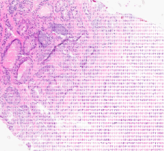 Paige, a provider of end-to-end digital pathology solutions and clinical AI, has announced a collaboration with Microsoft to build what they refer to as the world’s largest image-based AI models for digital pathology and oncology.