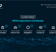 Medical artificial intelligence (AI) solution development company VUNO gained the Class IIa CE markings for five of their AI solutions.