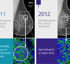 Imago Systems Announces Collaboration With Mayo Clinic for Breast Imaging