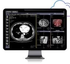 Infinitt PACS 7.0 is a faster, more powerful viewer that was built from the ground up to support AI for image analysis and for operational/ workflow improvements in radiology