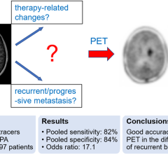 Does a new or increasing contrast enhancement on T1 MRI represent a consequence of treatment or progressive/recurrent tumor? This common clinical dilemma can be resolved by amino acid PET with good diagnostic accuracy. 