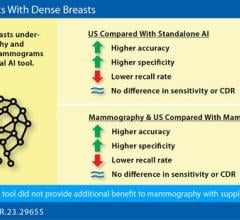 For patients with dense breasts undergoing screening in the incidence setting, a commercial AI tool did not provide additional benefit to mammography with supplementary ultrasound 
