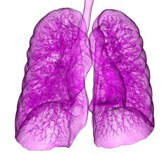 Lung cancer patients who are inactive prior to chemoradiation are less likely to tolerate treatment and more likely to see their cancer return