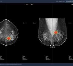 Developed by medical AI company Lunit, Software detects breast cancer with 97% accuracy; Study in Lancet Digital Health shows that Lunit INSIGHT MMG-aided radiologists showed an increase in sensitivity