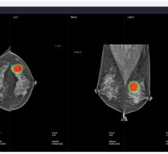 Lunit Unveiling AI-Based Mammography Solution at RSNA 2018