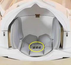 This self-powered sensor (circled in yellow) attached to a headrest within an MRI machine could help make imaging collection more efficient by detecting patient movement in real time.