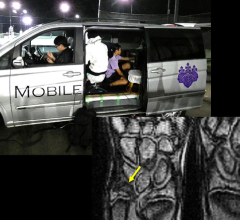 A portable MRI system that enables athletes to be screened for injuries before they exhibit any symptoms