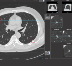 With Imaging Lab, Median will provide biopharmaceutical companies with new decision-making tools for clinical trials by leveraging images with data mining and Artificial Intelligence (AI) technologies from iBiopsy and radiomics