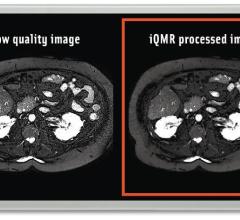 Medic Vision Wins Japanese PMDA Clearance for iQMR Image Reconstruction Solution