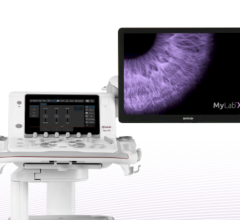 Esaote unveiled at European Congress of Radiology (ECR) 2023 in Vienna, MyLab X90, premium ultrasound system