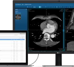 NucleusHealth, a provider of cloud-based medical image management technology and teleradiology services, announced today that it has received Conformité Européene (CE) Mark approval for Nucleus.io. 