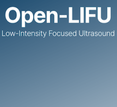 focused ultrasound
