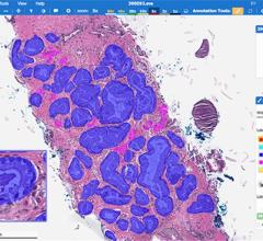 Paige Announces Clinical-grade Artificial Intelligence in Pathology