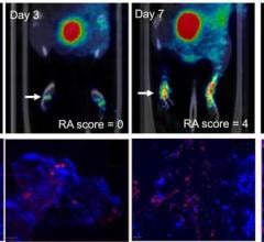  (A) PET images of [68Ga]Ga-DOTA-ZCAM241 uptake at baseline and 3, 7, and 12 days after injection as inflammatory arthritis developed in single representative individual mouse. Images are normalized to SUV of 0.5 for direct comparison between time points. (B) CD69 immunofluorescence Sytox (Thermo Fisher Scientific) staining of joints of representative animals during matching time points.