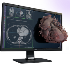 3-D software, medical image processing