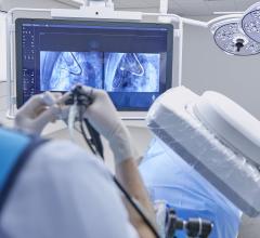 Philips Azurion Lung Edition supports high precision diagnosis and minimally invasive therapy in one room